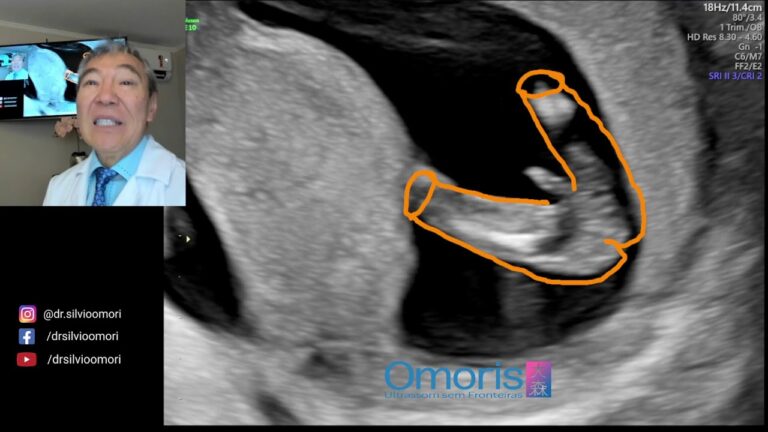 Desenvolvimento fetal: O que esperar durante as treze semanas de gesta&ccedil;&atilde;o