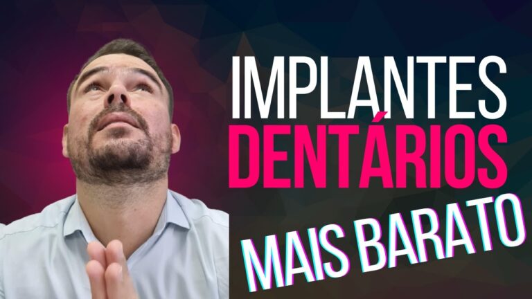 Implante Dental Econ&ocirc;mico: Encontre Op&ccedil;&otilde;es Baratas e Confi&aacute;veis