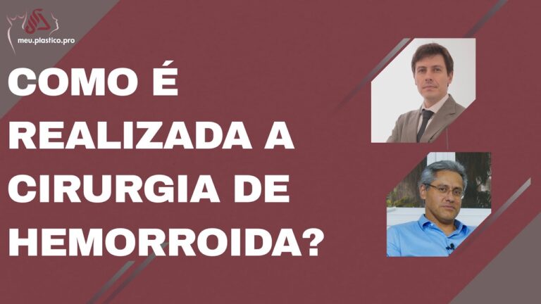 Guia Completo da Operação Hemorroida: Tudo o Que Você Precisa Saber