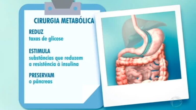 O custo da cirurgia metab&oacute;lica: o que considerar