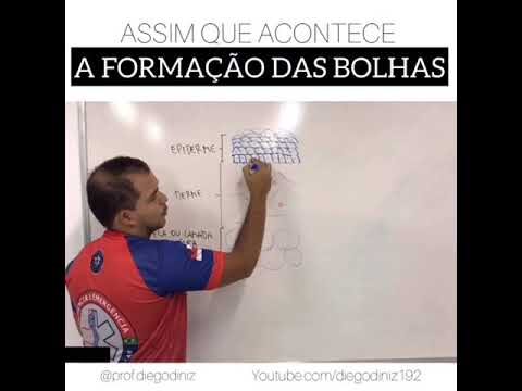 Entendendo as Flictenas: Causas, Sintomas e Tratamentos